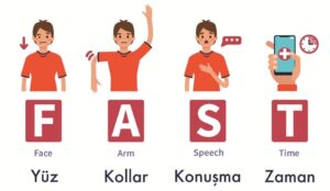 erkeklerde felç