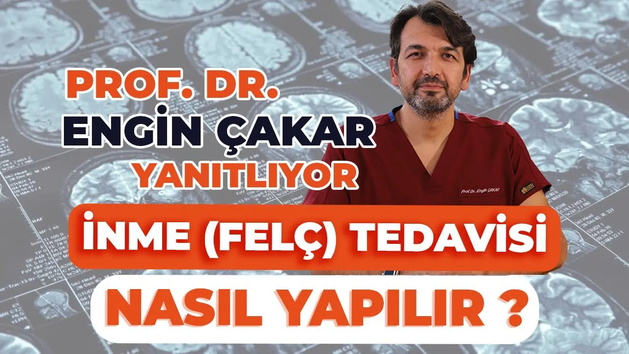 İnme (Felç) Tedavisi Nasıl Yapılır?