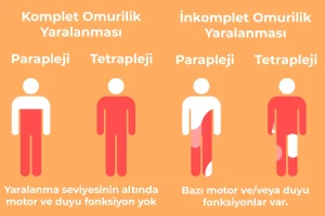 parapleji nedir, quadripleji nedir, komplet ve inkomplet yaralanmalar nelerdir